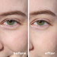 Hydrogel Under Eye Patches